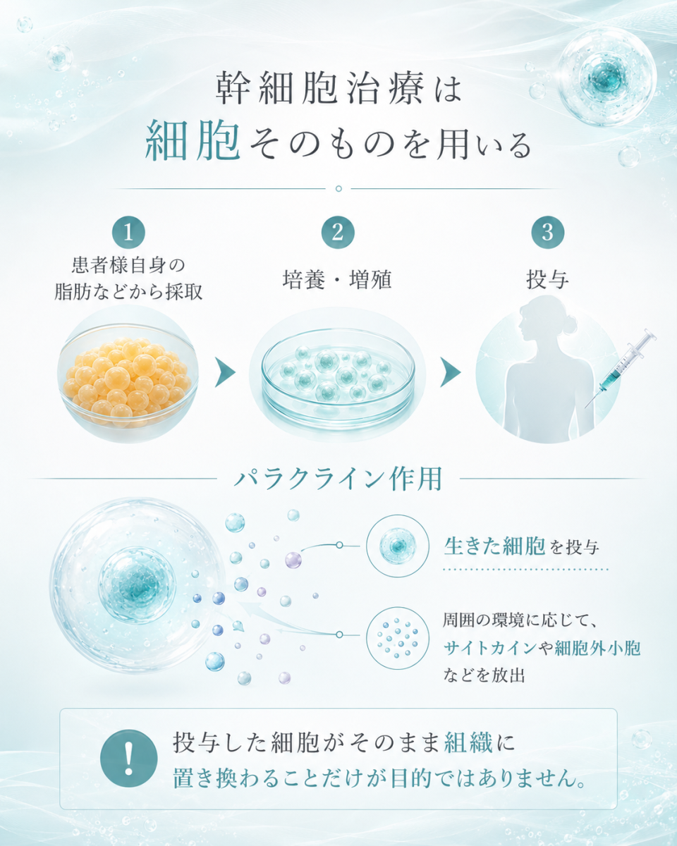 幹細胞治療が生きた細胞そのものを用い、採取、培養、投与やパラクライン作用の考え方を含めて整理した図解